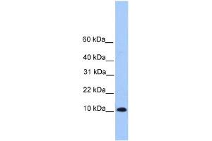 Image no. 1 for anti-Trafficking Protein Particle Complex 6B (TRAPPC6B) (Middle Region) antibody (ABIN2785353)