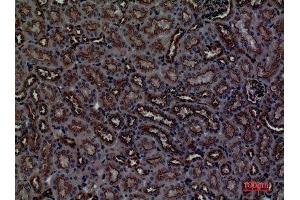 Image no. 3 for anti-CUB Domain Containing Protein 1 (CDCP1) (Internal Region) antibody (ABIN3187811)