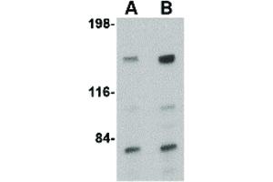 Image no. 2 for anti-Ca++-Dependent Secretion Activator (CADPS) (C-Term) antibody (ABIN6656945)
