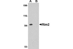 Image no. 1 for anti-Regulating Synaptic Membrane Exocytosis 2 (RIMS2) (Middle Region) antibody (ABIN1031067)