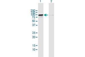 Image no. 1 for anti-RIO Kinase 1 (RIOK1) (AA 1-568) antibody (ABIN949706)
