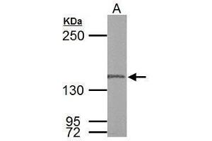 WB Image DNA polymerase gamma antibody detects POLG protein by Western blot analysis.