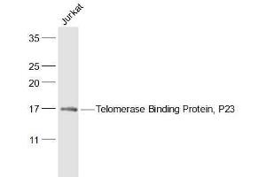 Image no. 1 for anti-Prostaglandin E Synthase 3 (Cytosolic) (PTGES3) (AA 31-130) antibody (ABIN736223)