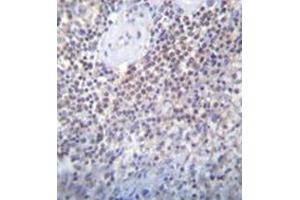 Image no. 3 for anti-Protein Associated with Topoisomerase II Homolog 2 (PATL2) (AA 165-196), (Middle Region) antibody (ABIN954004)