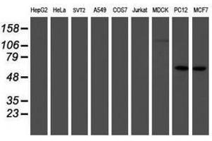 Image no. 9 for anti-Interferon Regulatory Factor 6 (IRF6) antibody (ABIN1498901)