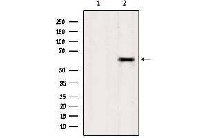 Image no. 2 for anti-Tectonic Family Member 1 (TCTN1) (N-Term) antibody (ABIN6265507)