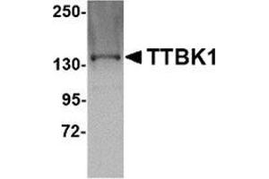 Image no. 2 for anti-tau Tubulin Kinase 1 (Ttbk1) (C-Term) antibody (ABIN501089)