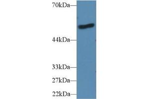 Image no. 5 for Lipopolysaccharide Binding Protein (LBP) ELISA Kit (ABIN6720569)