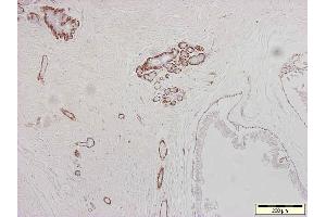 Image no. 1 for anti-Actin, alpha 2, Smooth Muscle, Aorta (ACTA2) antibody (ABIN335372)