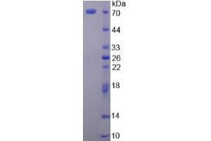 Image no. 1 for Secretogranin II (SCG2) (AA 31-617) protein (His tag) (ABIN6237130)