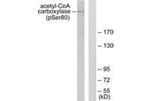 Western blot analysis of extracts from 293 cells treated with EGF 200ng/ml 5', using Acetyl-CoA Carboxylase (Phospho-Ser80) Antibody.