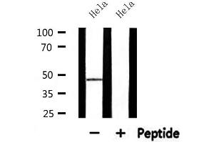 Image no. 1 for anti-Abhydrolase Domain Containing 8 (ABHD8) antibody (ABIN6258530)
