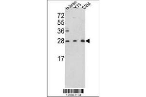 Image no. 1 for anti-Triosephosphate Isomerase 1 (TPI1) (AA 68-96), (N-Term) antibody (ABIN389457)