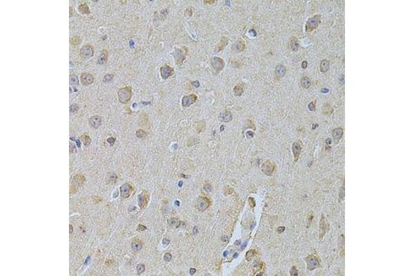 NME1 antibody  (C-Term)