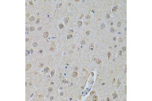 Image no. 1 for anti-Non-Metastatic Cells 1, Protein (NM23A) Expressed in (NME1) (C-Term) antibody (ABIN3020815)