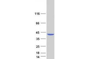 Image no. 1 for ADP-Ribosylarginine Hydrolase (ADPRH) protein (Myc-DYKDDDDK Tag) (ABIN2714432)