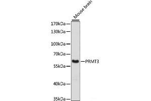 Western blot analysis of extracts of Mouse brain using PRMT3 Polyclonal Antibody at dilution of 1:3000.