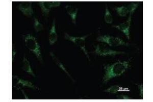 Image no. 2 for anti-Paired Box 8 (PAX8) antibody (ABIN933101)