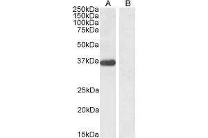 Image no. 3 for anti-Pancreas Specific Transcription Factor, 1a (PTF1A) (Internal Region) antibody (ABIN190768)