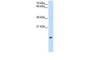 Image no. 1 for anti-NADH Dehydrogenase (Ubiquinone) 1 beta Subcomplex, 5, 16kDa (NDUFB5) (AA 69-118) antibody (ABIN6738155)