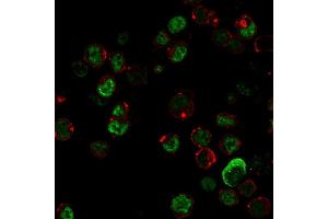 Image no. 5 for anti-Neurofilament, Light Polypeptide (NEFL) antibody (ABIN6940187)