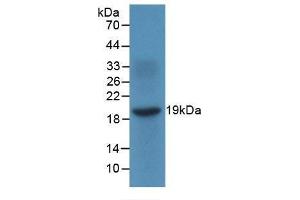 Image no. 1 for anti-gamma-Interferon-Induced Monokine (CXCL9) antibody (ABIN5983647)