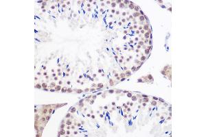 Geminin anticorps  (AA 1-209)