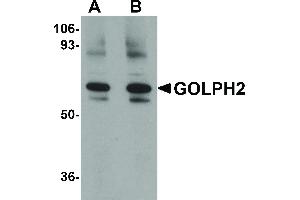Image no. 1 for anti-Golgi Membrane Protein 1 (GOLM1) (Internal Region) antibody (ABIN6656525)