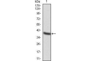 Image no. 2 for anti-Transcription Factor AP-2 alpha (Activating Enhancer Binding Protein 2 Alpha) (TFAP2A) (AA 1-100) antibody (ABIN5542419)
