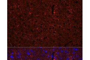 Immunofluorescence analysis of Mouse brain using GAD2 Polyclonal Antibody at dilution of 1:100 (40x lens).