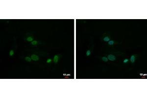 ICC/IF Image HMGB1 antibody detects HMGB1 protein at nucleus by immunofluorescent analysis.