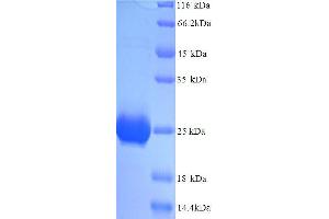 Prolactin (PRL) (AA 31-229), (full length) protein (His tag)