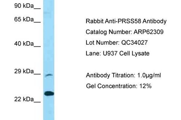 anti-Protease, serine, 58 (PRSS58) (C-Term) antibody