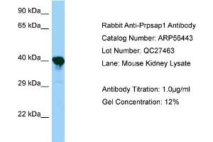 Image no. 1 for anti-phosphoribosyl Pyrophosphate Synthetase-Associated Protein 1 (PRPSAP1) (N-Term) antibody (ABIN2786705)