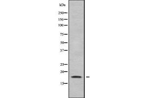 Image no. 2 for anti-Retinoic Acid Receptor Responder (Tazarotene Induced) 3 (RARRES3) antibody (ABIN6264643)