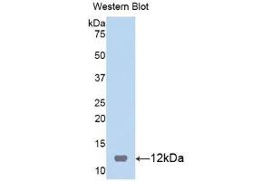 Image no. 1 for anti-S100 Calcium Binding Protein B (S100B) (AA 1-92) antibody (ABIN1078517)
