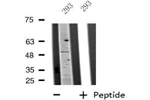 Image no. 2 for anti-Pleiomorphic Adenoma Gene-Like 1 (PLAGL1) (Internal Region) antibody (ABIN6258308)