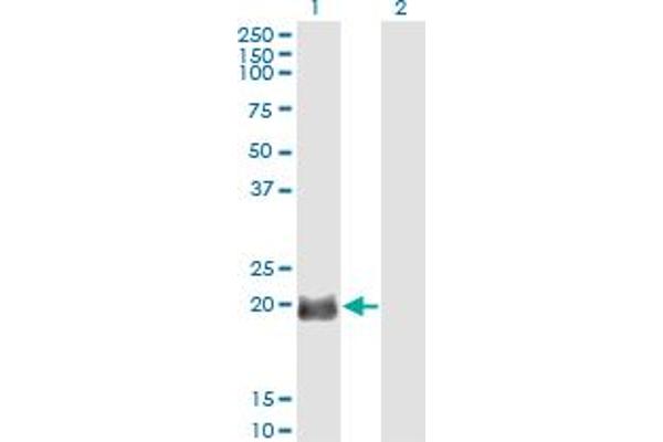 EXOSC1 antibody  (AA 1-195)