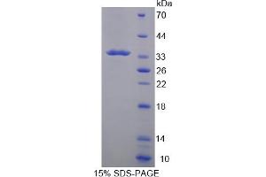 Image no. 1 for Tryptase beta 2 (TPSB2) (AA 30-276) protein (T7 tag,His tag) (ABIN6238186)