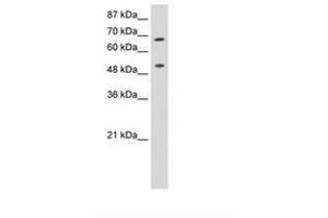 Image no. 3 for anti-THO Complex 1 (THOC1) (AA 511-560) antibody (ABIN6736250)