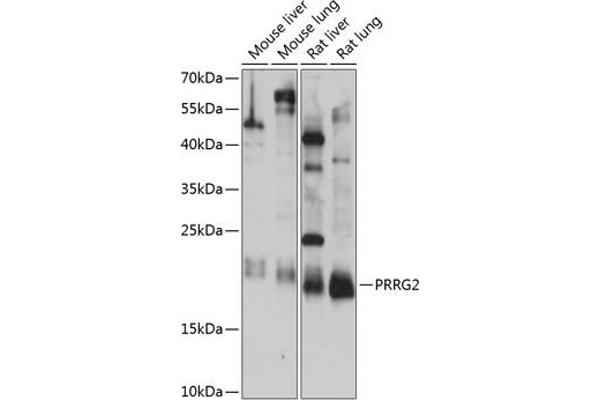 PRRG2 anticorps  (AA 1-179)