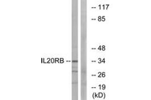 Image no. 1 for anti-Interleukin 20 Receptor beta (IL20RB) (AA 141-190) antibody (ABIN1534416)