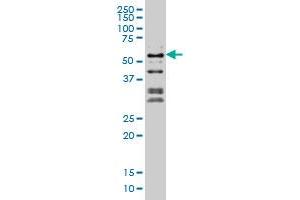 Image no. 2 for anti-Nuclear Factor I/C (CCAAT-Binding Transcription Factor) (NFIC) (AA 314-423) antibody (ABIN561977)