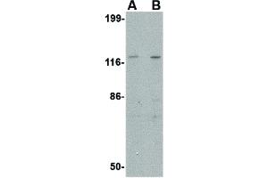Image no. 1 for anti-SLIT and NTRK-Like Family, Member 3 (SLITRK3) (C-Term) antibody (ABIN6655879)