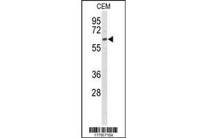 Western Blotting (WB) image for anti-EH-Domain Containing 3 (EHD3) antibody (ABIN2158657)