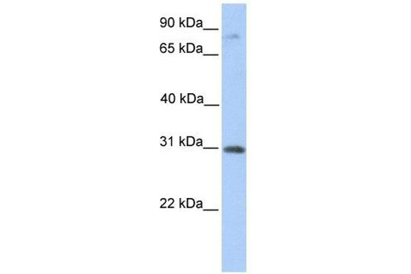 anti-Abhydrolase Domain Containing 13 (ABHD13) (C-Term) antibody