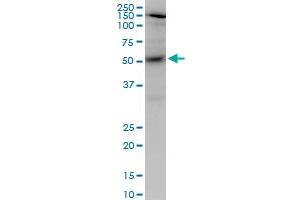 Image no. 3 for anti-V-Akt Murine Thymoma Viral Oncogene Homolog 1 (AKT1) (AA 1-480) antibody (ABIN559829)