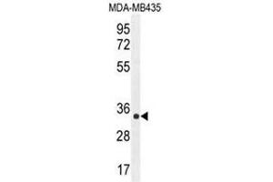 Image no. 3 for anti-AlkB, Alkylation Repair Homolog 6 (ALKBH6) (AA 123-153), (Middle Region) antibody (ABIN950353)