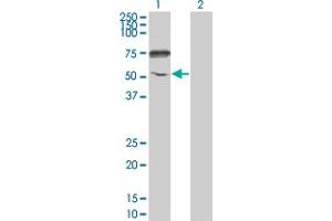 Image no. 2 for anti-Ectonucleotide Pyrophosphatase/phosphodiesterase 5 (ENPP5) (AA 24-477) antibody (ABIN566196)