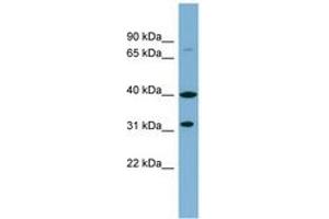 Image no. 1 for anti-Ferric-Chelate Reductase 1 Like (FRRS1L) (AA 215-264) antibody (ABIN6742026)